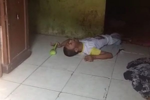 Miris! Anak Yatim Piatu di Kota Serang Menderita Lumpuh Diduga Akibat Gizi Buruk
